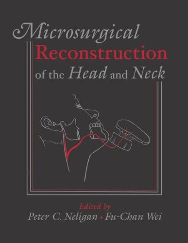 Microsurgical Reconstruction of the Head and Neck (Original PDF from Publisher + Videos) Microsurgical Reconstruction of the Head and Neck (Original PDF from Publisher + Videos)