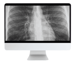 ARRS Cranial Nerve Imaging: From the Least to the Last 2022 ( Videos )
