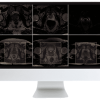 ARRS Pearls and Pitfalls in Prostate and Pelvic Imaging 2021 ARRS Pearls and Pitfalls in Prostate and Pelvic Imaging 2021