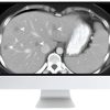 ARRS SAR Disease-Focused Panels: Cancer Imaging and Reporting Guidelines 2021 ( VIDEOS) ARRS SAR Disease-Focused Panels: Cancer Imaging and Reporting Guidelines 2021 ( VIDEOS)