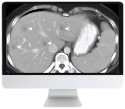ARRS SAR Disease-Focused Panels: Cancer Imaging and Reporting Guidelines 2021 ( VIDEOS)