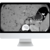 ARRS State of the Art Liver Imaging in Cirrhosis 2021 ( VIDEOS)