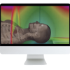 ARRS Understanding MR Safety Through AI Software Simulation 2021 ( VIDEOS)