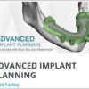 Advanced Implant Planning Course (Full Arch with Blue Sky and Meshmixer) Advanced Implant Planning Course (Full Arch with Blue Sky and Meshmixer)