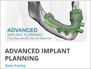 Advanced Implant Planning Course (Full Arch with Blue Sky and Meshmixer) Advanced Implant Planning Course (Full Arch with Blue Sky and Meshmixer)
