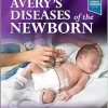 Avery’s Diseases of the Newborn, 11th edition (True PDF) Avery’s Diseases of the Newborn, 11th edition (True PDF)