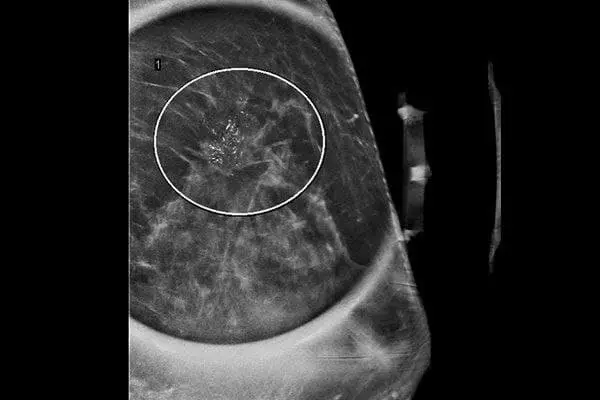 MRIOnline Imaging Mastery Series: High Risk Screening Breast MRI 2021 MRIOnline Imaging Mastery Series: High Risk Screening Breast MRI 2021