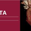 Classic Lectures in Cardiac CTA 2018