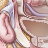 Cleveland Clinic Comprehensive Hernia Center 2019 Cleveland Clinic Comprehensive Hernia Center 2019