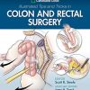 Cleveland Clinic Illustrated Tips and Tricks in Colon and Rectal Surgery (EPUB and pdf) Cleveland Clinic Illustrated Tips and Tricks in Colon and Rectal Surgery (EPUB)