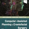 Computer-Assisted Planning In Craniofacial Surgery (EPub+Converted PDF+Videos) Computer-Assisted Planning In Craniofacial Surgery (EPub+Converted PDF+Videos)