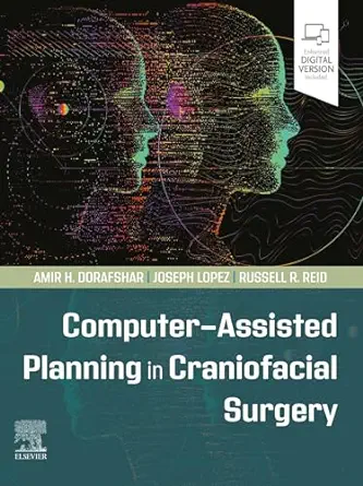 Computer-Assisted Planning In Craniofacial Surgery (EPub+Converted PDF+Videos) Computer-Assisted Planning In Craniofacial Surgery (EPub+Converted PDF+Videos)
