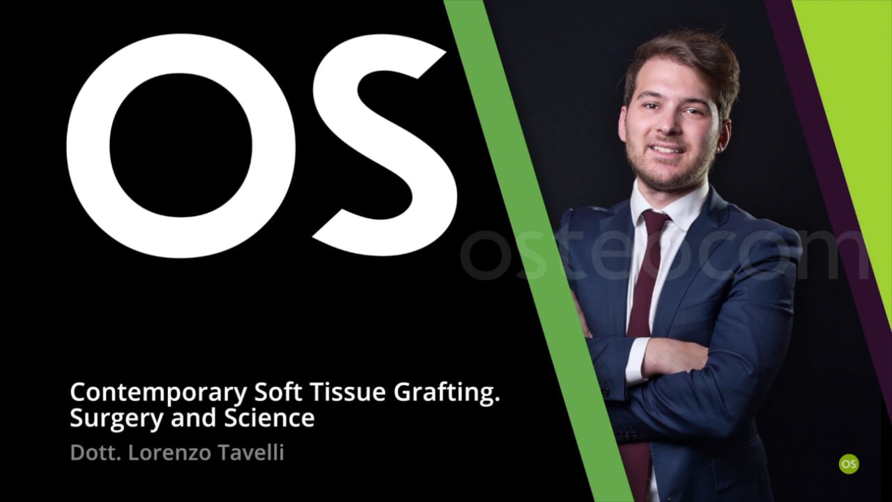 Contemporary Soft Tissue Grafting, Surgery and Science Contemporary Soft Tissue Grafting, Surgery and Science