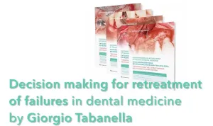 Decision Making for Retreatment of Failures in Dental Medicine Decision Making for Retreatment of Failures in Dental Medicine