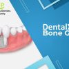 DentalXP Bone Grafts DentalXP Bone Grafts