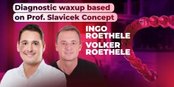 Diagnostic waxup based on Prof. Slavicek concept