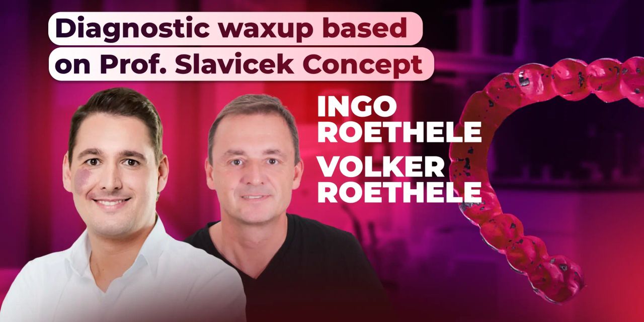 Diagnostic waxup based on Prof. Slavicek concept Diagnostic waxup based on Prof. Slavicek concept