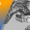 DigitalDDS EXOCAD AOX Advanced EXOCAD for all things AOX DigitalDDS EXOCAD AOX Advanced EXOCAD for all things AOX