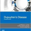 Dupuytren’s Disease: A Scientific Review (True PDF from Publisher) Dupuytren’s Disease: A Scientific Review (True PDF from Publisher)
