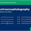 Electroencephalography: Textbook and Atlas (Original PDF from Publisher) Electroencephalography: Textbook and Atlas (Original PDF from Publisher)