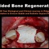 Guided Bone Regeneration: A 30 year Biological and Clinical Journey in Ridge Augmentation