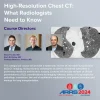 High-Resolution Chest CT: What Radiologists Need To Know – ARRS 2024 (Videos) High-Resolution Chest CT: What Radiologists Need To Know – ARRS 2024 (Videos)