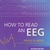 How to Read an EEG, 2nd Edition (Original PDF from Publisher) How to Read an EEG, 2nd Edition (Original PDF from Publisher)