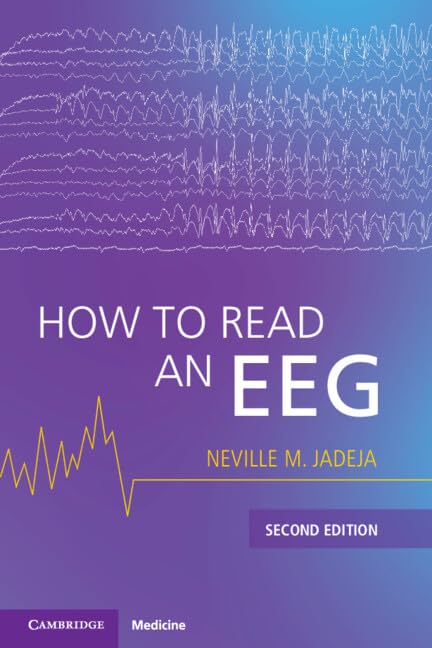 How to Read an EEG, 2nd Edition (Original PDF from Publisher) How to Read an EEG, 2nd Edition (Original PDF from Publisher)