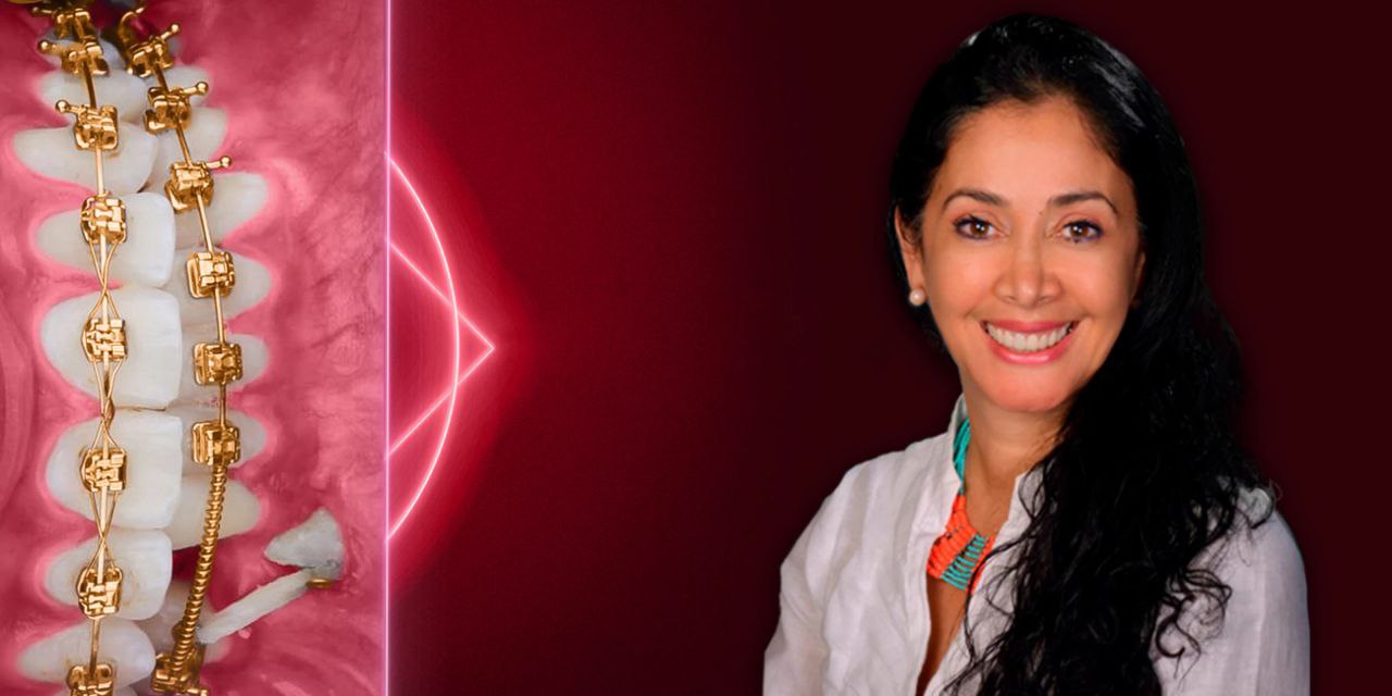 Impaction Treatment Author’s Protocols, Mistakes and Solutions Impaction Treatment Author’s Protocols, Mistakes and Solutions
