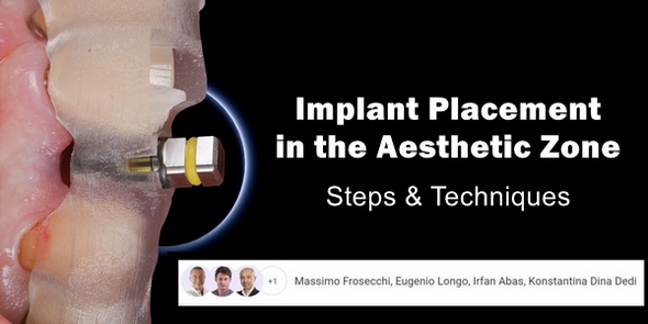 Soft Tissue Plastic Surgery Around Implants Soft Tissue Plastic Surgery Around Implants