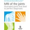 MRI of the joints (Original PDF from Publisher)
