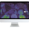 ARRS Breakthroughs in Nuclear Medicine for Neurology and Oncology 2021 ( VIDEOS)