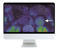 ARRS Breakthroughs in Nuclear Medicine for Neurology and Oncology 2021 ( VIDEOS)
