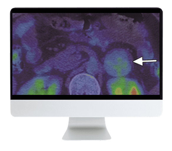 ARRS Breakthroughs in Nuclear Medicine for Neurology and Oncology 2021 ( VIDEOS) ARRS Breakthroughs in Nuclear Medicine for Neurology and Oncology 2021 ( VIDEOS)