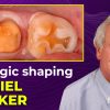 OHI-S Biologic Shaping a conservative alternative to crown lengthening 4 lessons 1h 54m OHI-S Biologic Shaping a conservative alternative to crown lengthening 4 lessons 1h 54m