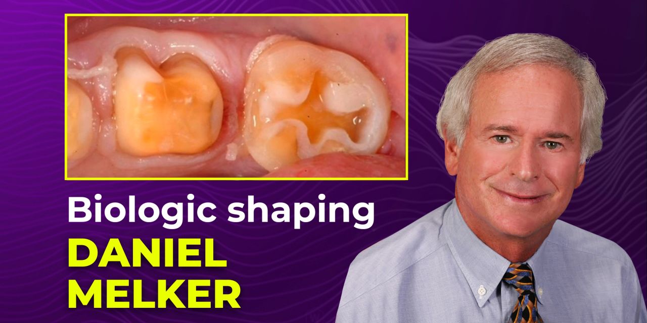 OHI-S Biologic Shaping a conservative alternative to crown lengthening 4 lessons 1h 54m OHI-S Biologic Shaping a conservative alternative to crown lengthening 4 lessons 1h 54m