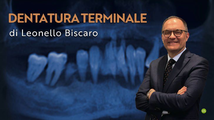 Osteocom dentatura terminale by Leonello Biscaro – italian Osteocom dentatura terminale by Leonello Biscaro – italian