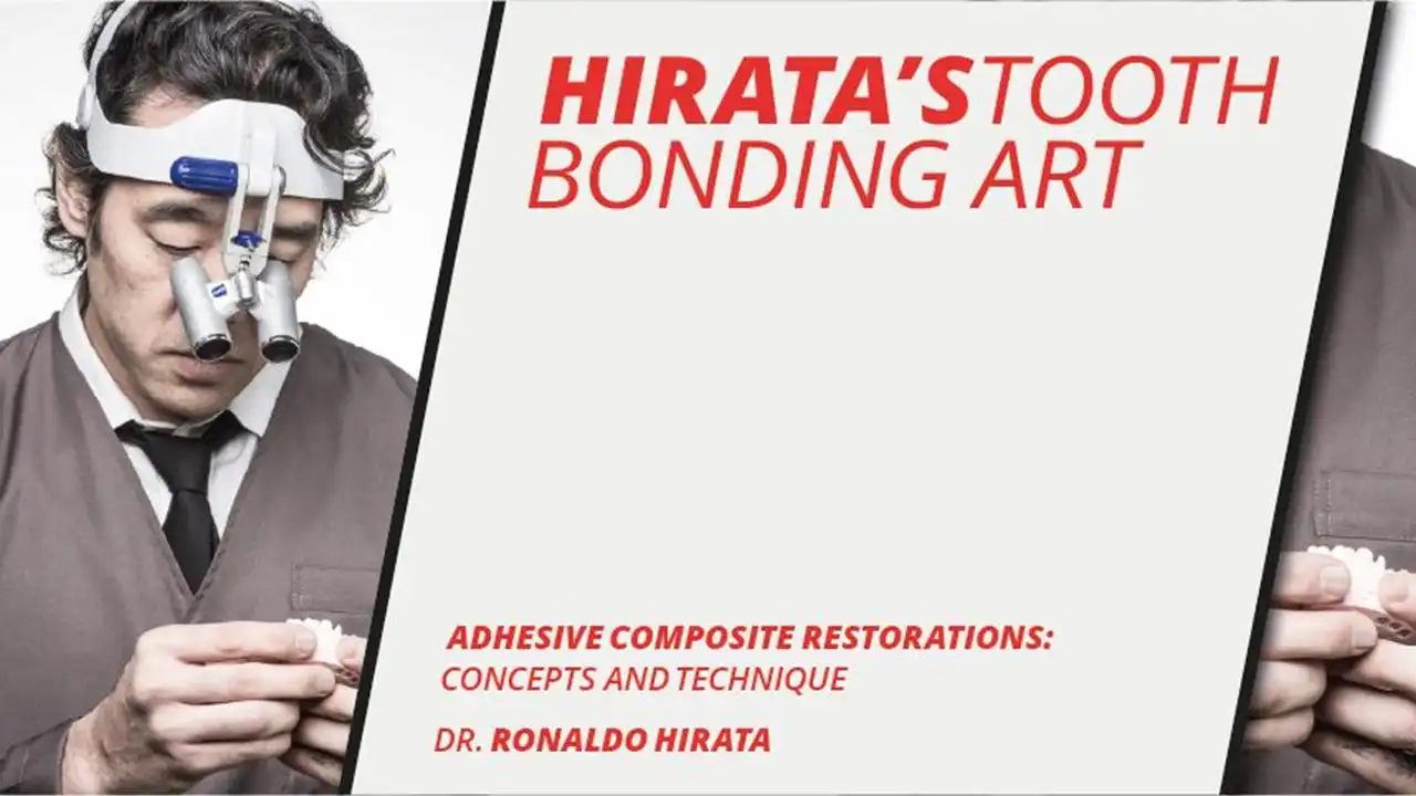 Osteocom Hirata’s Tooth Bonding Art – Adhesive Composite Restorations Concept and Technique Osteocom Hirata’s Tooth Bonding Art – Adhesive Composite Restorations Concept and Technique