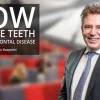 Osteocom How To Save Teeth With Periodontal Disease