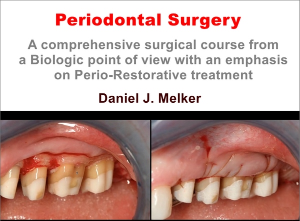 Periodontal Surgery: A Comprehensive Surgical Course Periodontal Surgery: A Comprehensive Surgical Course
