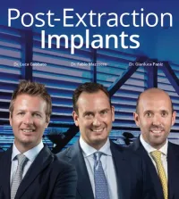 Post-Extraction Implants (Video course) Post-Extraction Implants (Video course)