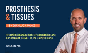 Prosthesis and Tissues (Prosthetic Management of Periodontal and Peri-Implant Tissues) Prosthesis and Tissues (Prosthetic Management of Periodontal and Peri-Implant Tissues)