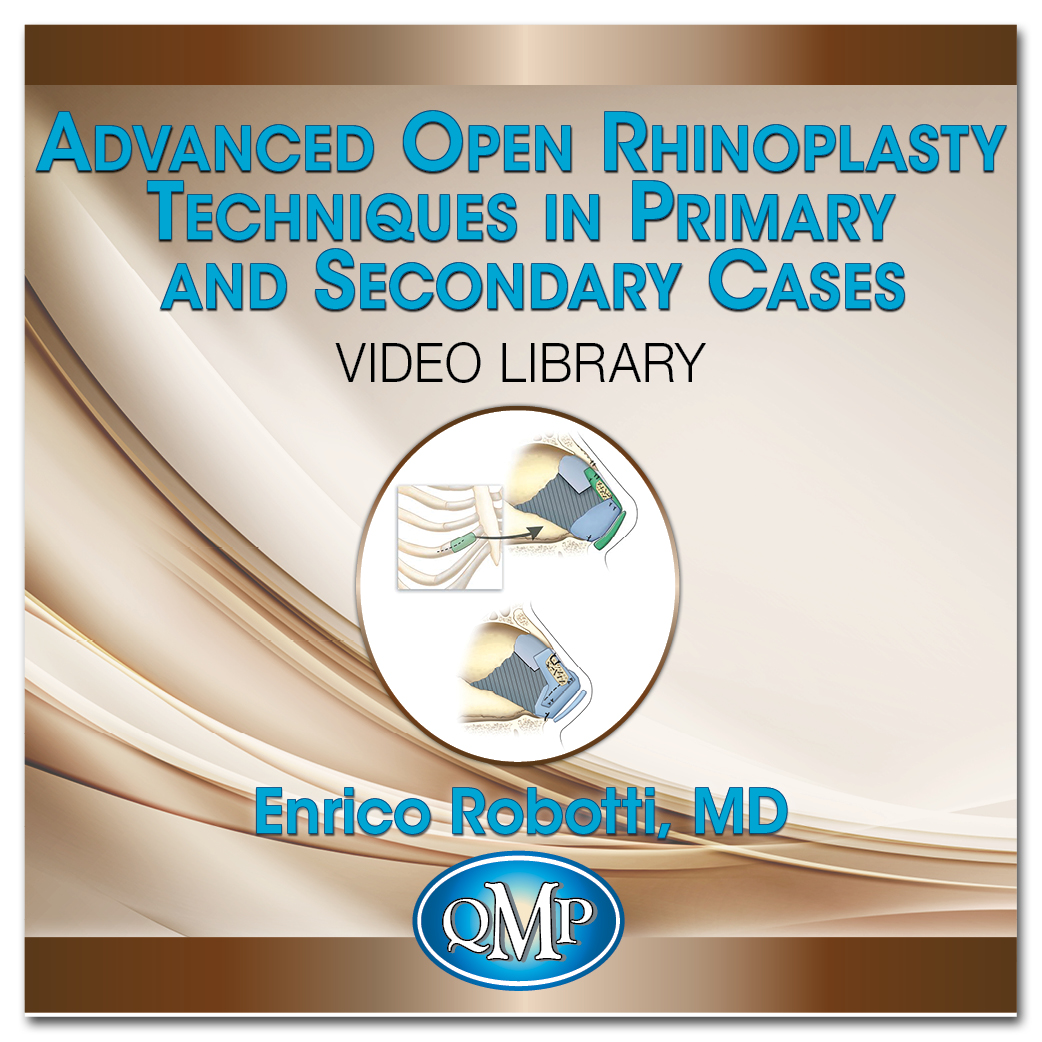 Quality Medical Publishing Advanced Open Rhinoplasty Techniques in Primary and Secondary Cases 2016 QMP Advanced Open Rhinoplasty Techniques in Primary and Secondary Cases 2016