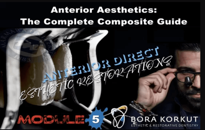 Anterior Aesthetics: The Complete Composite Guide Anterior Aesthetics: The Complete Composite Guide