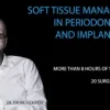 Soft Tissue Management in Periodontology and Implantology Soft Tissue Management in Periodontology and Implantology