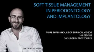 Soft Tissue Management in Periodontology and Implantology Soft Tissue Management in Periodontology and Implantology