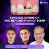 Surgical Extrusion and Replantation of Teeth Surgical Extrusion and Replantation of Teeth