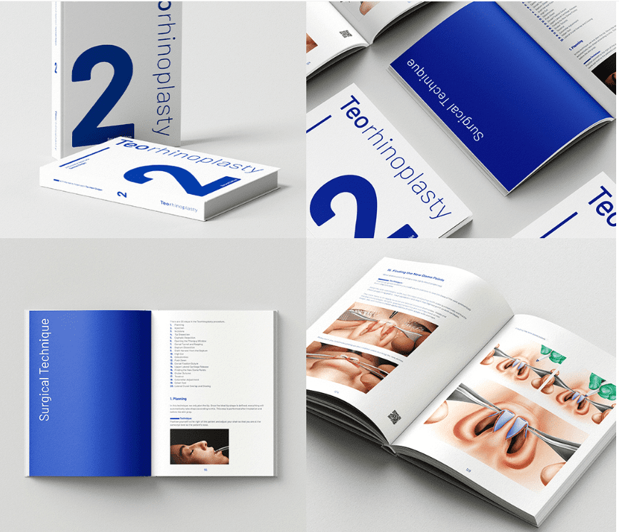 Teorhinoplasty Book (2nd Edition) Teorhinoplasty Book (2nd Edition)