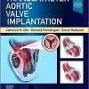 Transcatheter Aortic Valve Implantation (Original PDF from Publisher) Transcatheter Aortic Valve Implantation (Original PDF from Publisher)