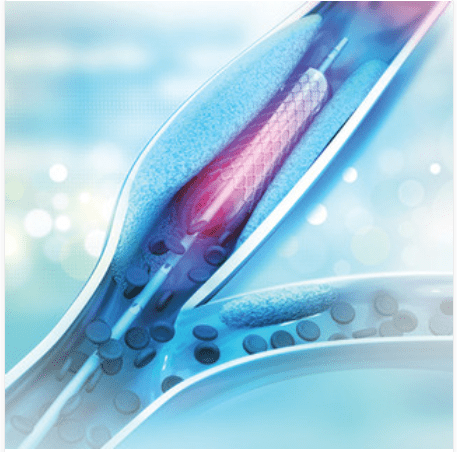 UCLA Comprehensive Review and Update of What’s New in Vascular and Endovascular Surgery 2023 UCLA Comprehensive Review and Update of What’s New in Vascular and Endovascular Surgery 2023